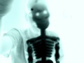 Xray Zach